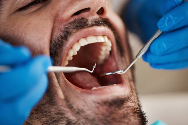 Best Holiday Emergency Dentist in Ballville, OH