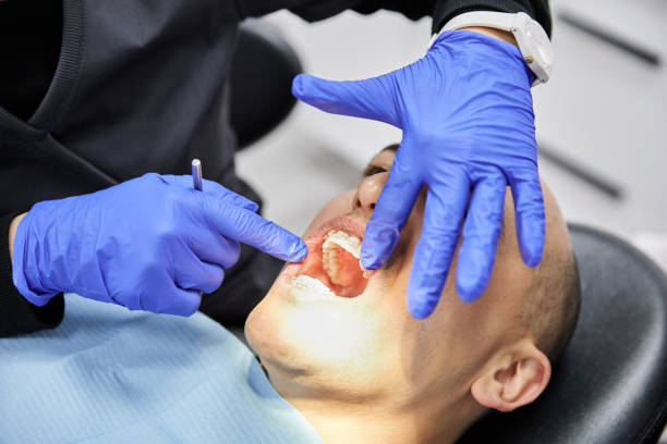 Best Weekend Emergency Dentist in Ballville, OH